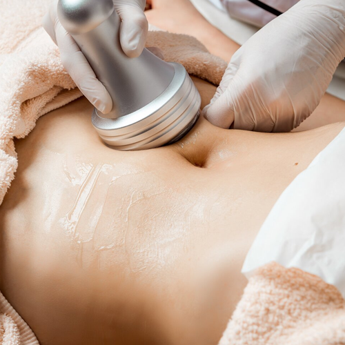 CAVITATION